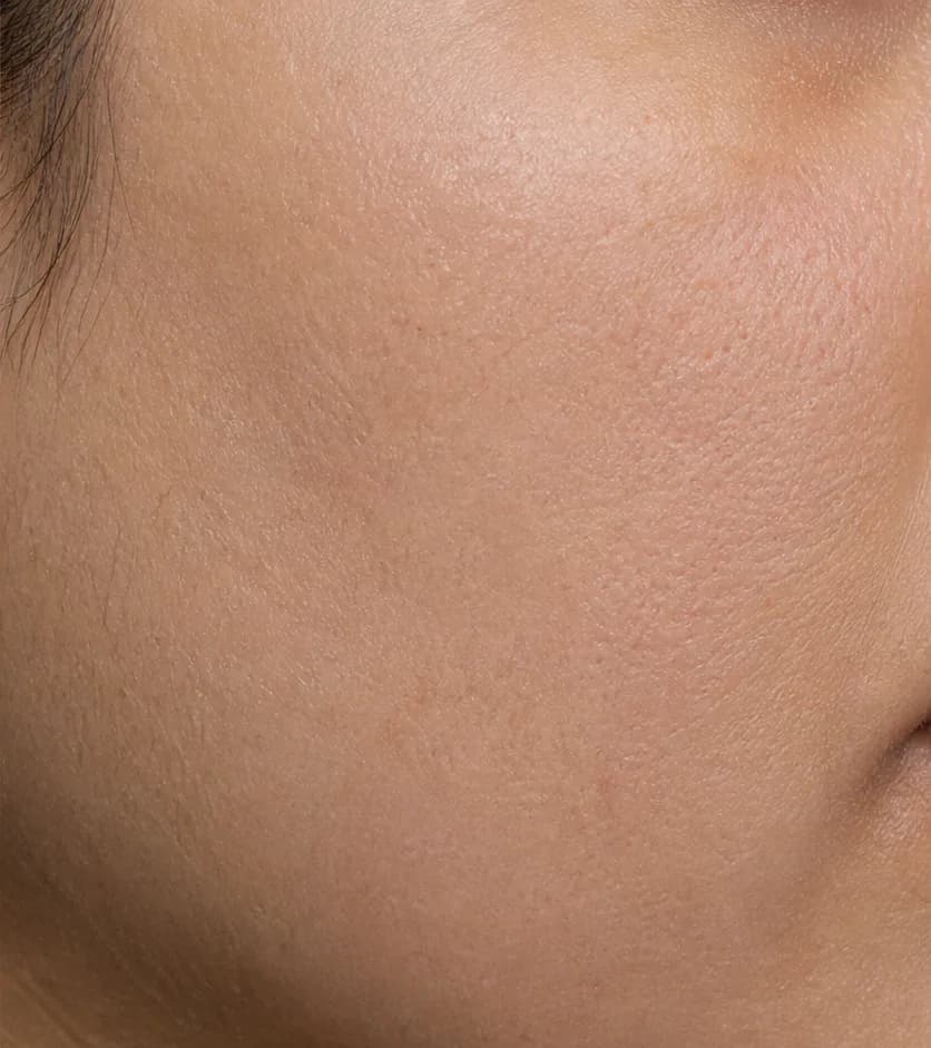 After 12 weeks — 12-week visual study · unretouched