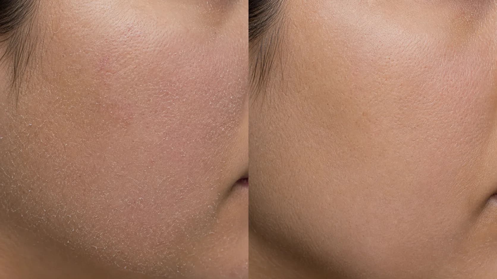 Barrier Protocol — before & after, 12 weeks