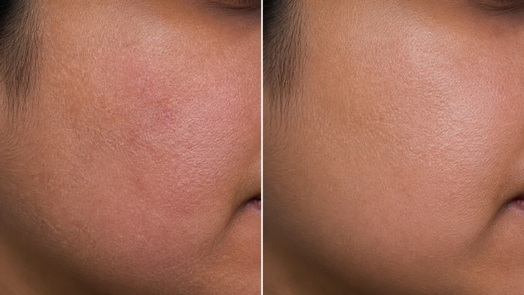 Barrier Protocol — before & after, 8 weeks