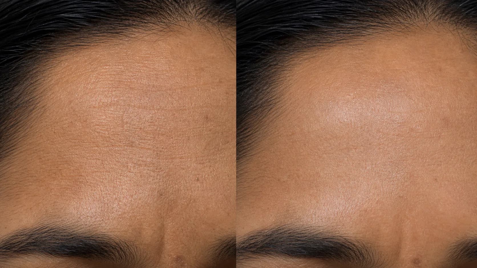 Renewal Protocol — before & after, 12 weeks