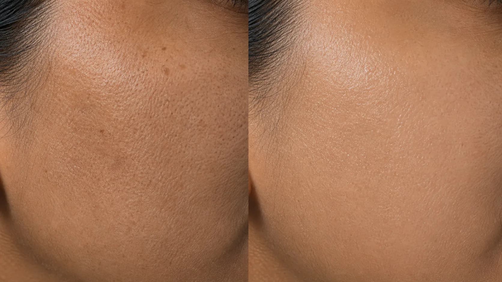 Renewal Protocol — before & after, 8 weeks