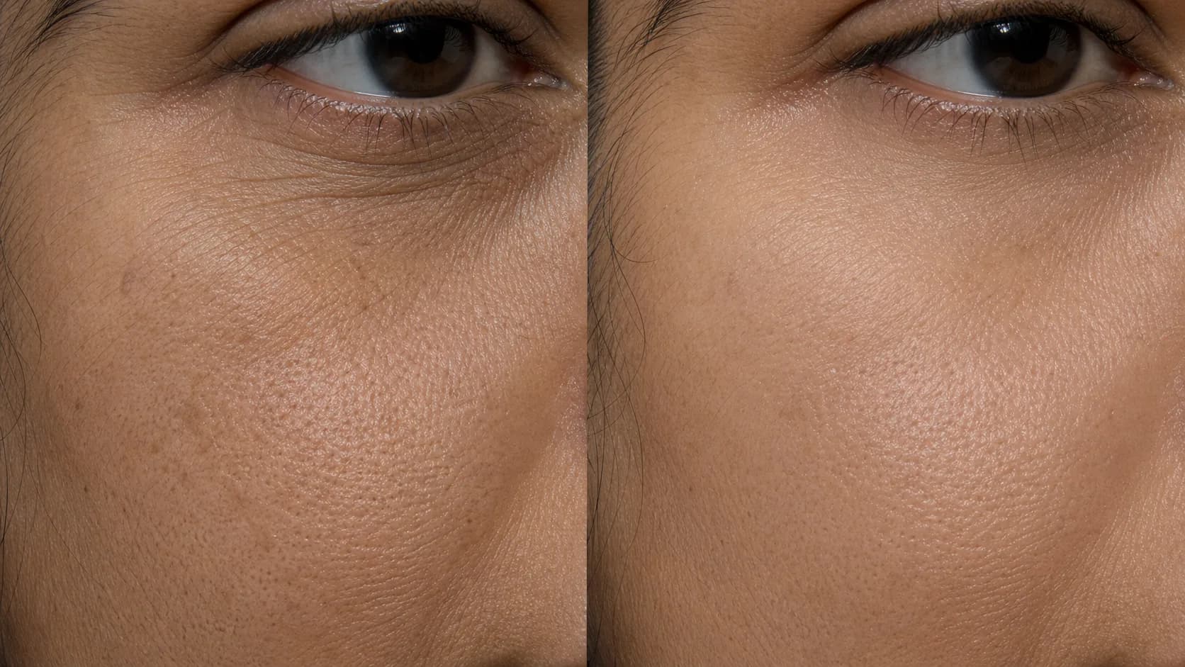 Renewal Protocol — before & after, 12 weeks